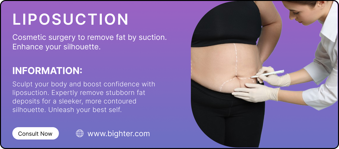 Liposuction